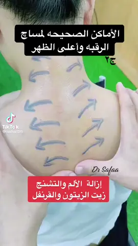 #مساچ_علاجي #الكتفين #تشنجات_العضلات #الألام #تشنج_العضلات #الأكتاف #تدليك #الظهر 