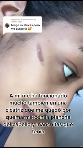 Respuesta a @Vanesa Sons #fakebody #skincare #rutinaderostro #manchasenlacara 