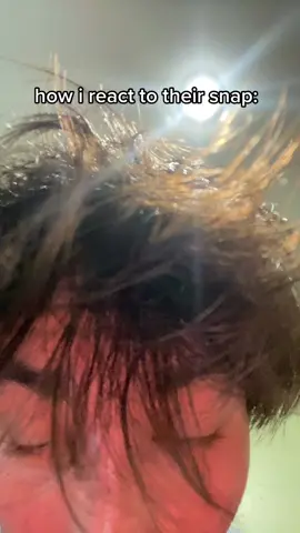 this or a really up close eye pic #fyp #foryou #relatable 