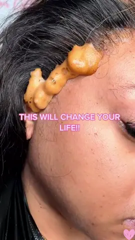 One of the biggest secrets to flawless install! #baldcap #baldcapmethod #baldhead #nikapslay #nikapslaykit #nikapslaylacetintmousse 