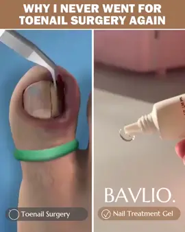 🍀EFERO NAIL TREATMENT REPAIR GEL🍀