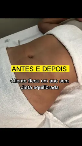 #massage #estetic #radiofrequency #reels #viral 