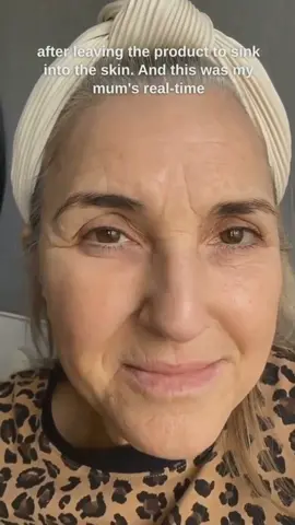 Wow! 😱 😱  I apply this cream to my mother's face. The result is impressive... #harveyross #miracleretinol #skincare #antiaging #tipsforgirls