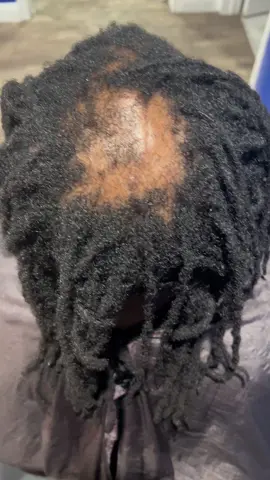#locs #locstyles #dreads #naturalhair #dreadlocks #braids #locnation #locjourney #starterlocs #dreadstyles #thinlocs #hair #hairlosscoverage #menwithbaldspots #baldspot #loctician #naturalhairstyles #explorepage #retwist #dreadhead #menwithlocs #menslocstyles #loclife #locmaintenance #loclove #dreadlocs #definedroots #thenextepisode #drdre  @Beats by Dre #snoopdogg @Snoop Dogg 