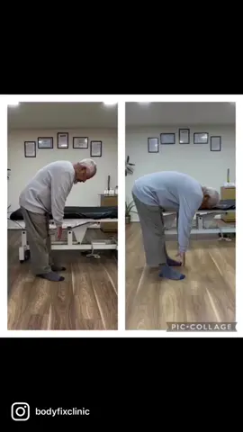 Lower back pain treatment for my 80 years old patient. unable to walk without walking stick for no longer then 5 mins after that he would get numbness in the legs and extreme pain in the lower back.  7-8/10 pain.  Restricted range of movement.   . MRI report shows degeneration in L4 and L5 also L1 and L3 effected too.  . He tried many different treatment like physio, osteo and massage therapists, as usual block bookings. He spent so much money on the treatments and herbal medicines but zero results. . After just one appointment using @kassermethod pain level reduced to 0/10, increased range/quality of movement AND walking without his walking stick.  . I can not explain how happy he was feeling, he hugged me 3 times, he could not believe that he was standing and surprised that he could walk without walking stick.  . Aftercare provided.  .  I can help with: Lower Back Pain Posture Correction Rotator Cuff Injury Frozen Shoulder Golfers Elbow Tennis Elbow Sciatica Pain Neck Pain Bulge Disc .  I don't believe in block bookings, just one appointment and aftercare.With aftar care you can take care of yourself in your comfort zone and save money. I am not here just for money, I am very passionate about what I do and enjoy helping people. I always put my heart and soul in every treatment I do to get the best possible results on the day!!!!!!! . #london #neckpain #osteo #chiro #physio #manipulation #backpain #physiotherapy #sciatica #lowerbackpain #shoulderpain #frozenshoulder #impingement #osteopata #osteopatia #chiropractor #gym #bodybulding #iastm #manualtherapy #ilford #eastlondon #f #fyp #fypシ #fypage #fypシ゚viral #viral 