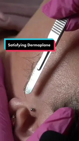 So satisfying 😍 dermaplaning is definitely one of my favorite services to do! #dermaplane #dermaplaneasmr #asmrsounds #asmrtiktoks #GenshinImpact33 