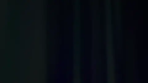 Glue Trip - Elbow Pain 🚀🌻#fypdongggggggg #fyp #viral  #lagitinggi