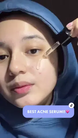 Replying to @🦋🦋 SUMPAH INI BAGUS BANGET! skrng kondisi kulit kaya lagi on-off gt🥹 #lacoco 