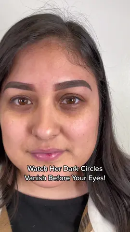 #darkcircles #darkcirclesundereyes #darkcirclestreatment #darkcirclesremover #darkcircle_undereye #darkcirclescamouflage #darkcircletips #darkcirclesremedy #darkundereye #darkundereyehack #skincamouflagetraining #TheRealPussinBoots #skincamouflage #paramedicaltattoo #skincamouflageservices #wednesday #wednesdayaddams #wednesdayhumpday #humpday #darkcircleschallenge #elpaso #elpasotx #austin #atx #fyp #avatar #fypシ #explore #pmu #trend #pmuartist #pmuacademy #undereye #undereyebags #skin #skincare #skincaretips #skin101  #healyourself #healyoself #cali #austintx #elpasotx #915 #fthood #ftbliss #armywife #wednesday #trending #trendingsong #eyes #inyoureyes 
