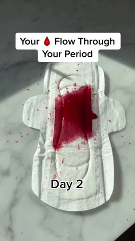 Your 🩸 flow through your period. Does your period look like this? #period #periodsbelike #periodproblems #periods #womenshealth 
