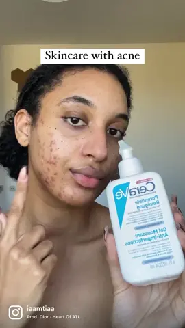 Acne SKINCARE Routine. More is Less 🧼 #acne #acnetreatment #acnepositivity #acnepositivity #pimples #pimpleproblems #bouton #acnefree #acneskincare #acnefighter #acnetips #conseils #conseilsacne #sopk 