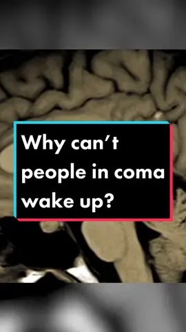 Why can’t people in coma wake up? #EduTok #eli5 #explainervideo 