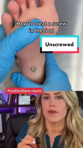 Replying to @bunnylove3211 Reacting to a screw in the foot!  #Doctor #doctorreacts #doctorsoftiktok #learnsomethingnew #medical #surgery #medicalvideos #doctors #podiatry #podiatrist #footsurgeon #surgeon #surgeons #nurse #nurses #healthcare #scrublife #medicalhumor #scrubslife #podiatric #medicine 