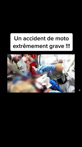 #pourtoi #devinelapersonne #pompier #samu #appelledurgence #police #hopital #accident #moto 