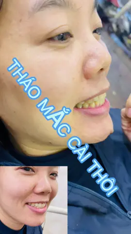 #CapCut #thaomaccai #niengrang #rubydental THÁO MẮC CÀI ĂN TẾT!!!!!