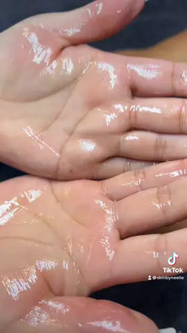 #microdermabrasion #hands #dryskin #exfoliate #glymedplus #dermalogica #chemicalpeel #winter #smoothskin #handtreatment