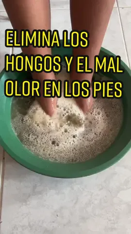 Esta receta elimina los hongos y el mal olor en los pies #recetas #natural #hongos 