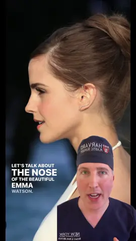 What celebrity nose should I do next? #emmawatson #harrypotter #nosejob #rhinoplasty #fyp  Of note, I have never seen her as a patient and I am not making any commentary on procedures she may or may not have had. 