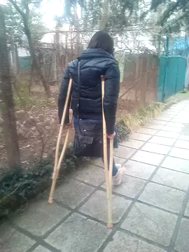 #amputee #oneleg #amputeewoman #ionaamp https://ampangela.gumroad.com