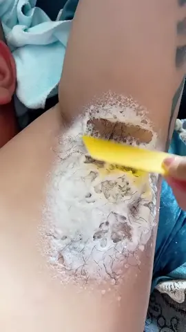Easy hair removal #tiktokmademebuyit #tiktokshop #haircream #smoothing #hairremoval 