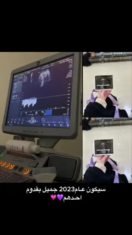 كنا أربعة وراح نصير أحلا خمسة 💖💙✨🤩🥳#بيبي_جديد #اطفال#ليكاتكم💞🔥 #fypシ゚viral🖤tiktok #ترند_تيك_توك_مشاهير #GenshinImpact33 #اكسبلورexplore #dancewthpubgm💞 #تركيا_اسطنبول_العراق_سوريا_مصر_االسعو 