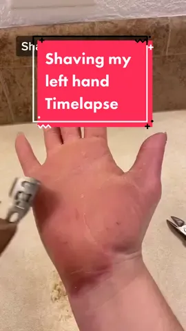 Shaving my right hand on TikTok live 😊 I have a #raredisease #geneticmutation called Diffuse Epidermolytic Palmoplantar Keratoderma Vörner-type #rarediseaseawareness #callousremoval #parmeseanpalms #callousedhands #skindisease #rareskincondition #callousremover #callousshaver #selfcareisforeveryone 
