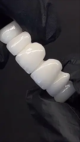 Full arch zirconium crowns 💎 #artdent_dental_laboratory #dentallab #dentaltech #dentaltechnology #dentalrestoration #dentalcrowns #tooth #teeth #newteeth #newsmile #smilemakeover #smilemore #dentist #dentistry #digitaldentistry #cadcamdentistry #zr #zirconia #zirconiacrown 