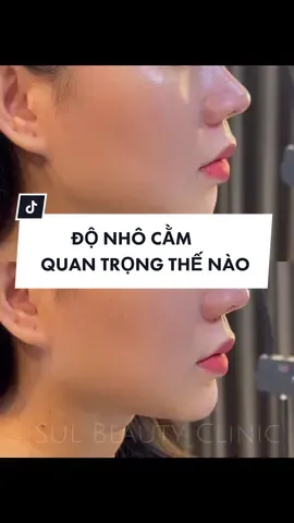 Độ nhô cằm quan trọng thế nào ? #sulbeauty #tiêmcằm #tiemfiller #tiemcamvline 