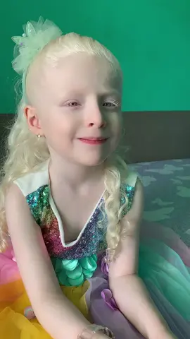 Conociendo un poco de Kaily💖👩🏻‍🦳 #Albinismo 