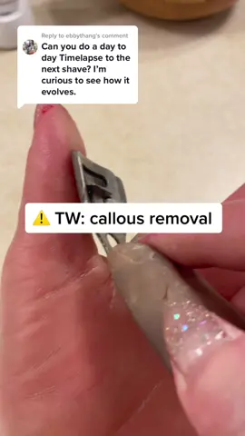 Replying to @ebbythang progress of callous growth over the last 11 days. Join me for my live tomorrow! #palmoplantarkeratoderma #callousremover #callousshaver #callousremoval #rareskincondition #eppk #parmeseanpalms #callousedhands #geneticmutation #geneticdisease #raredisease #rarediseaseawareness #callousedhandsclub #selfcareisforeveryone 