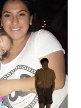 My arms are so annoying  #fyp #trend 