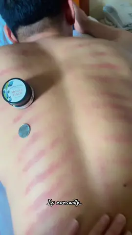 Kerokin suami #fypシ゚viral  #kerok 