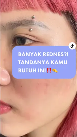 BANYAK REDNES?! TANDANYA KAMU BUTUH INI‼️🤏 Redness datang, Hydrating Toner solusinya💯 CUKUP 5 MENIT AJA buat mengurangi kemerahan diwajah🤩 ##salsacosmetic#beautyiseasy