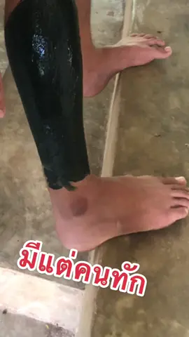 ใครตาตุ่มด้านควรดู 🥺🥺 7 วันรู้เรื่อง #เคลียร์บัทครีม #ครีมก้นรดา #ใช้ดีจริงไม่จกตา 