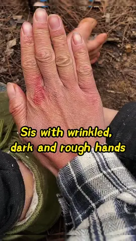 Wrinkled,dark and rough hands?try this hand serum serum ✨✨#handserum #handcare #roughhands #skincare #hocinna #handcream 
