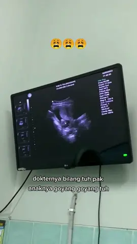 maaf nak, entah bapak terlalu gembira atau apa #fy #fyp #viralvideo #viraltiktok ##usg #bumil #bumilsehat #usg3d #hamil 