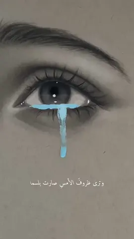 الرد على @شُــوشاٰ  إشاره 🥹☁️✨#fypシ #eyes #foryou 