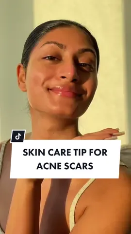 Sunscreens are essential ✨ if you don’t want the hyperpigmentation or acne scars to get darker. I love @belif  sunscreen 💖 because it leave no white cast on my brown skin and has no mineral oil which can cause more breakouts ☺️ It’s available at @sephoracanada  #BelifPartner #BelifCanada #AquabombSPF #BelifBFF #SPF7DaysAWeek 