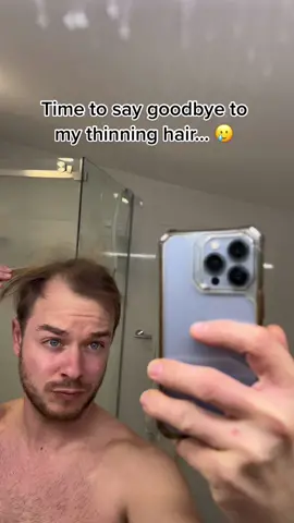 It is what it is. #hairloss #menhairloss #menhealth #hair #hairstyle #buzzcut #balding #baldhead #bald 