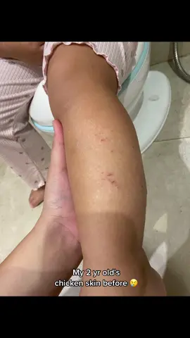 Mommy approved 😱 Thank you for this video @Patrisha Fuentebella 🥹❤️  #fy #fyp #skintokph #glycerub 