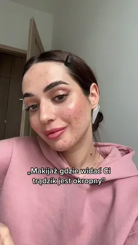Przekaz na Walentynki ❣️ #tradzik #acnepositivity #makijazbezpodkladu 