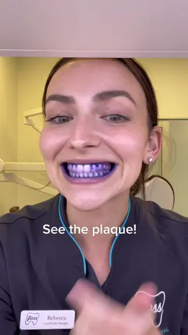 Plaque Disclosing Tablets are a great tool to check where you might be missing when you’re brushing 🦷 ☕️🥤🍫🍩 Come see us @flossfamilydental #dentist #plaque #oralhealththerapist #redlands #teeth #brushing #electrictoothbrush #xyzbca 