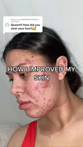 Replying to @user8806802143692 HOW I IMPROVED MY SKIN 💕  In the morning I cleanse my face with La Roche Posay Effaclar, dry your skin skin by dabbing with a clean towel, 2 drops La Roche Posay Vitamin C10 serum all over face and neck, moisturize with La Roche Posay Effaclar Duo + and then lock it all in with La Roche Posay Cicaplast baume. For night time I use the same cleanser and dry my skin with the same technique but then I use La Roche Posay Retinol (every 2-3 days), moisturize with La Roche Posay Effaclar Duo + and like in the morning I will lock it all in with La Roche Posay Cicaplast baume.  I think cutting back on processed foods, sugars and dairy while consuming alot more water really helped and the exercise & sweat must have really helped as well!!  #larocheposay #skincareroutine #skincaretips #transformation #healthandwellness 