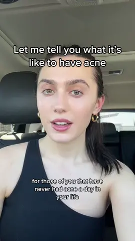 I’m so tired of seeing people who have never had acne talk crap about someone else’s skin. And I’m also tired of those same people trying to tell people with acne “how to fix it”. “Drinking more water” doesn’t fix it. When your acne is that bad, you are willing to try everything and anything and sometimes literally nothing works… not even accutane. I’ve been on accutane multiple times and my acne has always come back. The emotional toll that comes with acne is so so real and many people like myself go through a very depressive time. When your acne is that bad, it not only takes over your face, but it takes over your mind. It’s all we think about. Whether we are laying in bed trying to fall asleep, we are thinking about it because our face is throbbing in pain. When you are having a conversation with someone, all you think about is whether they are judging you for your acne. When you want to hangout with friends, but your acne is flaring up, you decide to stay home instead because you’re embarrassed. These are just some of the things that people who have never had acne will never understand. I don’t wish it upon anyone. #acnejourney #acnefighter #acneskin #acneproneskin #cysticacne #cysticacnejourney #cysticacnesurvivor #hormonalacne #hormonalacne #hormonalacnejourney #acne #pimples #pimple #accutane #accutanejourney #myacnestory #myacnejourney #myacnestruggle #MentalHealth #mentalhealthmatters #MentalHealthAwareness 