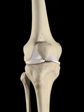 Knee joint replacement #fyp #3danimation #meditok 
