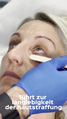 Stellt eure Fragen per DM 📬 #ehrenarzt #beautydoc #schönheitschirurgie #co2laser #laser #co2 