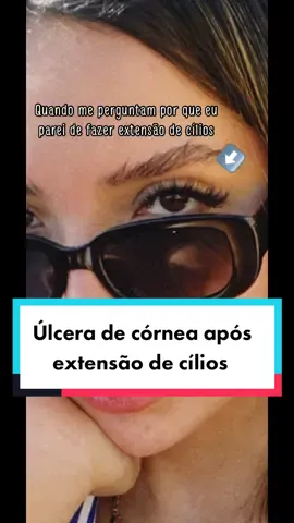 Obs. Esse olho NÃO é meu, mas de uma paciente que atendi #ulceradecornea #oftalmologia #med #ophthalmology 