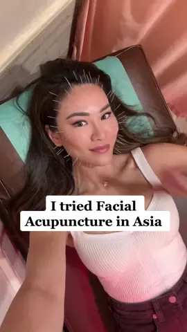 The only needles I can handle 💉 #acupuncture #skintok #skincare #asian #antiaging #fyp 