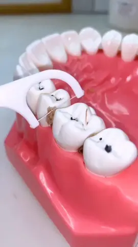 Benang gigi (dental floss) adalah seutas benang yang khusus dibuat untuk membersihkan sela gigi yang memang sulit dibersihkan dengan cara menyikat gigi