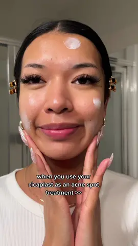 hydrating my acne spots works better for me than using acne spot treatments 😌 #acnetreatment #acneskin #acneskincare #acnespottreatment 
